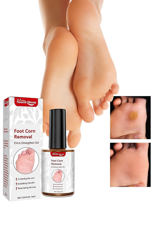 Feet Corn Removal Serum 30ml ( Pack Of 1 )