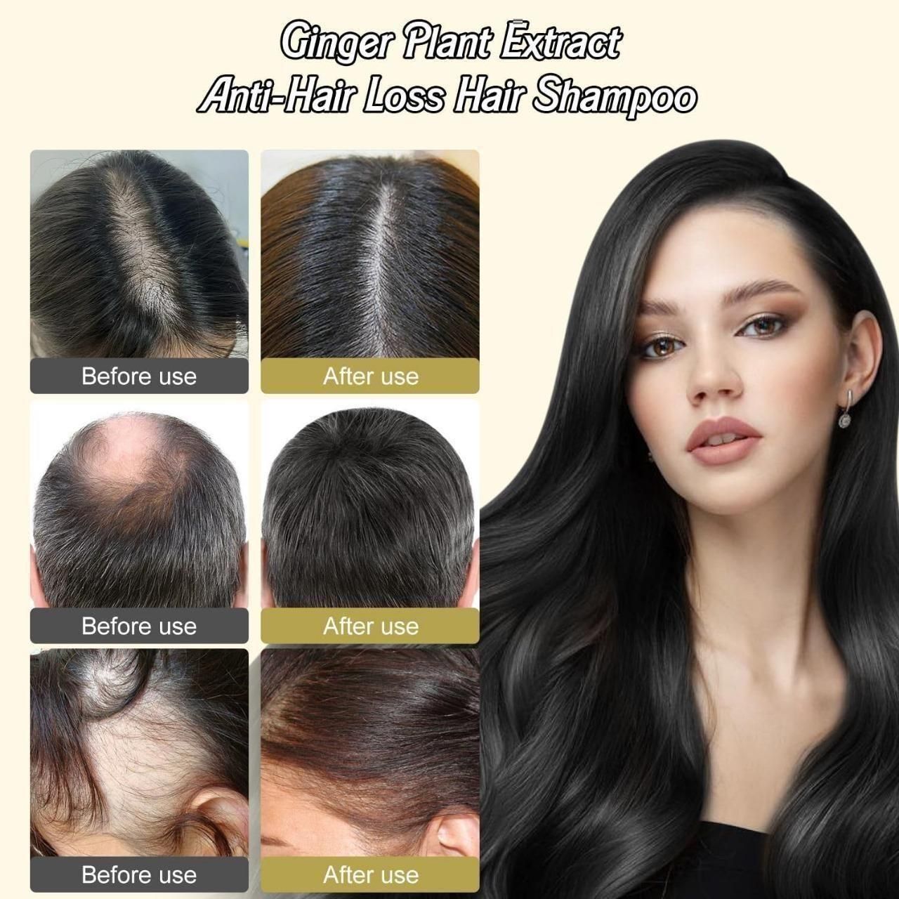 Anti-Hair Loss Hair Shampoo 200ml Pack of 3